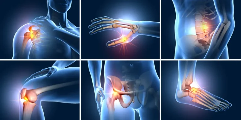 Overcome Osteoarthritis: 5 Pain-Relieving Exercises