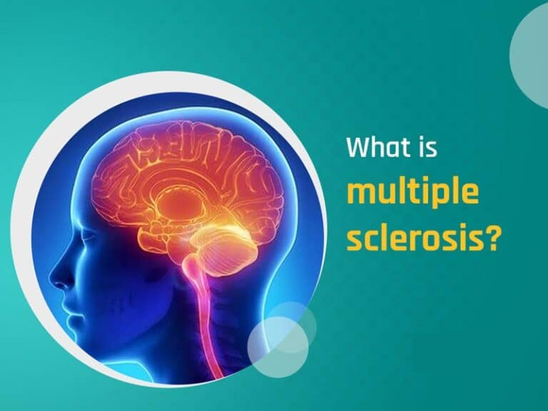 Understanding Multiple Sclerosis: Symptoms, Causes, Treatments, and Natural Approaches